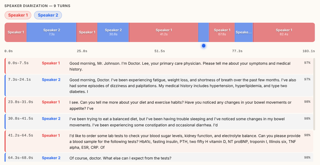 Speaker diarization — per-speaker timeline with transcript turns